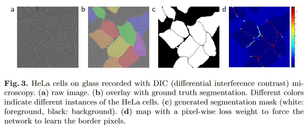 图片[3] - AI科研 编程 读书笔记 - 【人工智能】U-Net：使用CNN实现医学图像分割 - AI科研 编程 读书笔记 - 小竹の笔记本