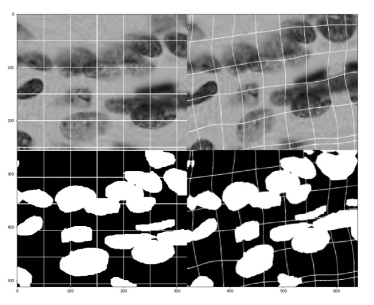 图片[5] - AI科研 编程 读书笔记 - 【人工智能】U-Net：使用CNN实现医学图像分割 - AI科研 编程 读书笔记 - 小竹の笔记本